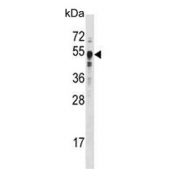 Western blot testing of human MCF7 cell lysate with SETD7 antibody. Predicted molecular weight ~41 kDa, commonly observed at 40-60 kDa.