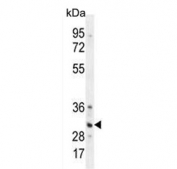 Western blot testing of human HeLa cell lysate with TRADD antibody. Predicted molecular weight ~34 kDa.