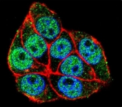 Immunofluorescent staining of human HeLa cells with TRADD antibody (green), DAPI nuclear stain (blue) and anti-Actin (red).