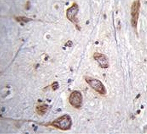 IHC testing of FFPE human brain tissue with Phospholipase C-L2 antibody. HIER: steam section in pH6 citrate buffer for 20 min and allow to cool prior to staining.
