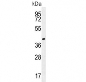 Western blot testing of human NCI-H460 cell lysate with Gamma-glutamyl hydrolase antibody. Expected molecular weight: 30-55 kDa depending on presence of the signal peptide and level of glycosylation.