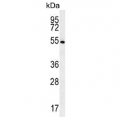 Western blot testing of human NCI-H460 cell lysate with GSR antibody. Predicted molecular weight ~56 kDa.