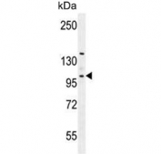 Western blot testing of human K562 cell lysate with Villin-like protein antibody. Predicted molecular weight ~96 kDa.