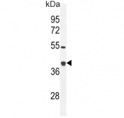 Western blot testing of mouse bladder tissue lysate with Glutaredoxin 3 antibody. Predicted molecular weight ~37 kDa.