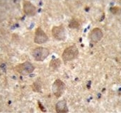 IHC testing of FFPE human brain tissue with Protocadherin alpha-C2 antibody. HIER: steam section in pH6 citrate buffer for 20 min and allow to cool prior to staining.
