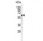 Western blot testing of human Jurkat cell lysate with NKD2 antibody. Expected molecular weight: 50-60 kDa.