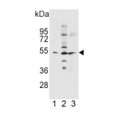Western blot testing of human 1) NCI-H460, 2) K562 and 3) A549 cell lysate with SLC36A1 antibody. Predicted molecular weight ~53 kDa.
