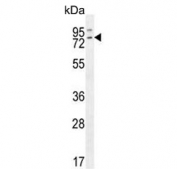 Western blot testing of human K562 cell lysate with CalDAG-GEFI antibody. Predicted molecular weight ~69 kDa. 