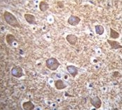 IHC testing of FFPE human brain tissue with CalDAG-GEFI antibody. HIER: steam section in pH6 citrate buffer for 20 min and allow to cool prior to staining.