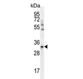 Western blot testing of human A549 cell lysate with ADP,ATP carrier protein 3 antibody. Predicted molecular weight ~32 kDa.