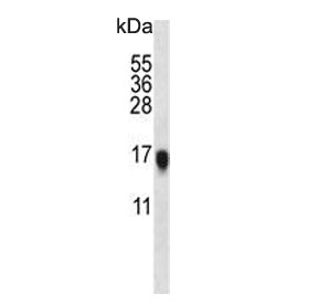 Western blot testing of mouse heart lysate with VSNL1 antibody. Predicted molecular weight ~17 kDa.