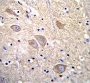 IHC testing of FFPE human brain tissue with VSNL1 antibody. HIER: steam section in pH6 citrate buffer for 20 min and allow to cool prior to staining.