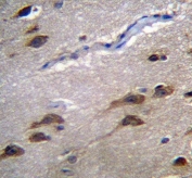 IHC testing of FFPE human brain tissue with GPR45 antibody. HIER: steam section in pH6 citrate buffer for 20 min and allow to cool prior to staining.