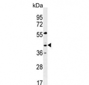 Western blot testing of human MDA-MB-435 cell lysate with GPR45 antibody. Predicted molecular weight ~42 kDa.