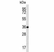 Western blot testing of human CCRF-CEM cell lysate with Follistatin like-3 antibody. Expected molecular weight: 25-39 kDa depending on glycosylation level.