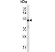 Western blot testing of human MCF7 cell lysate with Mboat4 antibody. Predicted molecular weight ~50 kDa.