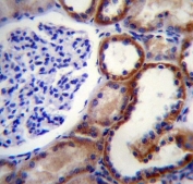 IHC testing of FFPE human kidney tissue with MAP3K15 antibody. HIER: steam section in pH6 citrate buffer for 20 min and allow to cool prior to staining.