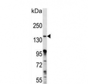 Western blot testing of mouse Neuro-2a cell lysate with MAP3K15 antibody. Predicted molecular weight ~147 kDa.