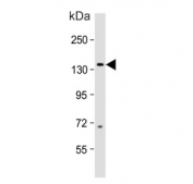 Western blot testing of human fetal brain lysate with MAP3K15 antibody. Predicted molecular weight ~147 kDa.