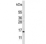 Western blot testing of mouse NIH 3T3 cell lysate with COX7A2L antibody. Predicted molecular weight ~13 kDa.
