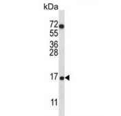 Western blot testing of human A549 cell lysate with COX7A2L antibody. Predicted molecular weight ~13 kDa.