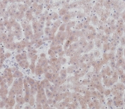 IHC testing of FFPE human liver tissue with UDP-glucuronosyltransferase 2B15 antibody. HIER: steam section in pH9 EDTA for 20 min and allow to cool prior to staining.