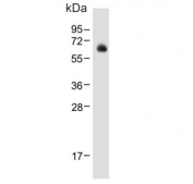 Western blot testing of human liver tissue lysate with UDP-glucuronosyltransferase 2B15 antibody. Predicted molecular weight ~61 kDa.