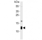 Western blot testing of rat heart tissue lysate with ATPase subunit F6 antibody. Predicted molecular weight ~13 kDa.