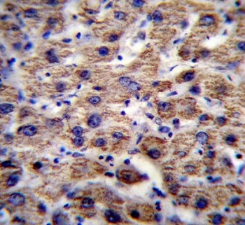 IHC testing of FFPE human liver tissue with ATPase subunit F6 antibody. HIER: steam section in pH6 citrate buffer for 20 min and allow to cool prior to staining.