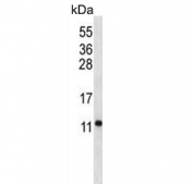 Western blot testing of mouse stomach tissue lysate with ATPase subunit F6 antibody. Predicted molecular weight ~13 kDa.