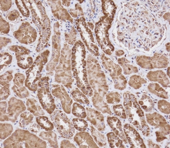 IHC testing of FFPE human kidney tissue with WFDC1 antibody. HIER: steam section in pH9 EDTA for 20 min and allow to cool prior to staining.