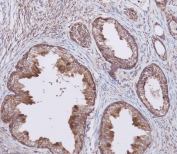 IHC testing of FFPE human prostate tissue with WFDC1 antibody. HIER: steam section in pH9 EDTA for 20 min and allow to cool prior to staining.