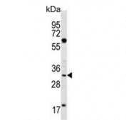 Western blot testing of human K562 cell lysate with Ficolin 3 antibody. Predicted molecular weight ~33 kDa.