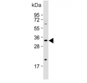 Western blot testing of human Jurkat cell lysate with Ficolin 3 antibody. Predicted molecular weight ~33 kDa.