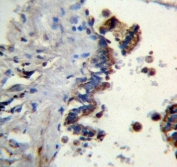IHC testing of FFPE human lung tissue with Ficolin 3 antibody. HIER: steam section in pH6 citrate buffer for 20 min and allow to cool prior to staining.