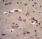IHC testing of FFPE human brain tissue with Dystrobrevin alpha antibody. HIER: steam section in pH6 citrate buffer for 20 min and allow to cool prior to staining.