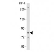 Western blot testing of human HepG2 cell lysate with Dystrobrevin alpha antibody. Predicted molecular weight ~84 kDa.