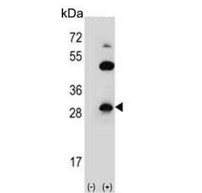 Western blot testing of 1) non-transfected and 2) transfected 293 cell lysate with CLDN2 antibody. Predicted molecular weight ~25 kDa.