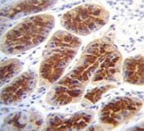 IHC testing of FFPE human stomach tissue with CLDN2 antibody. HIER: steam section in pH6 citrate buffer for 20 min and allow to cool prior to staining.