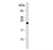 Western blot testing of human heart tissue lysate with CLDN2 antibody. Predicted molecular weight ~25 kDa.