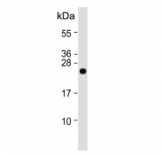 Western blot testing of human heart tissue lysate with CLDN2 antibody. Predicted molecular weight ~25 kDa.