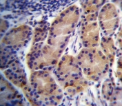 IHC testing of FFPE human stomach tissue with CYP2S1 antibody. HIER: steam section in pH6 citrate buffer for 20 min and allow to cool prior to staining.