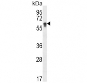 Western blot testing of human HepG2 cell lysate with CYP2S1 antibody. Predicted molecular weight ~56 kDa.