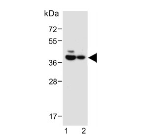 Western blot testing of 1) mouse heart and 2) rat heart lysate with LPAR6 antibody. Predicted molecular weight ~39 kDa.
