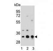 Western blot testing of human 1) U-251, 2) A549 and 3) Jurkat cell lysate with Tropomyosin 4 antibody. Predicted molecular weight ~33 kDa.