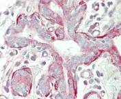 IHC testing of FFPE human breast tissue with Tropomyosin 4 antibody. HIER: steam section in pH6 citrate buffer for 20 min and allow to cool prior to staining.