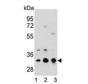 Western blot testing of human 1) U-251, 2) A549 and 3) Jurkat cell lysate with Tropomyosin 4 antibody. Predicted molecular weight ~33 kDa.