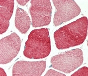 IHC testing of FFPE human skeletal muscle tissue with Tropomyosin 4 antibody. HIER: steam section in pH6 citrate buffer for 20 min and allow to cool prior to staining.