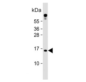 Western blot testing of human HeLa cell lysate with Tumor suppressor ARF antibody. Predicted molecular weight ~14 kDa.