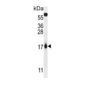 Western blot testing of human HEK293 cell lysate with Tumor suppressor ARF antibody. Predicted molecular weight ~14 kDa.